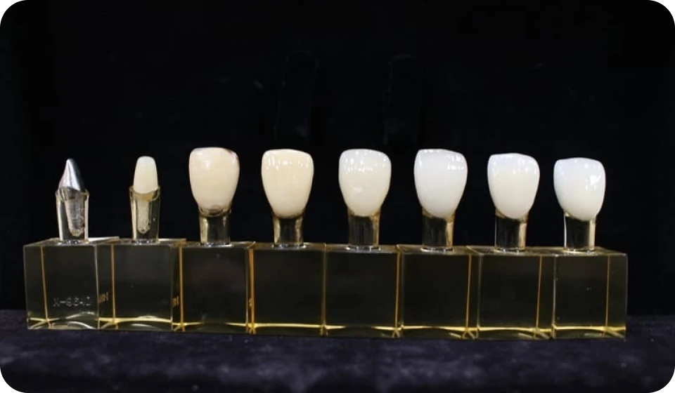 セラミック　気軽にコンプレックスを改善