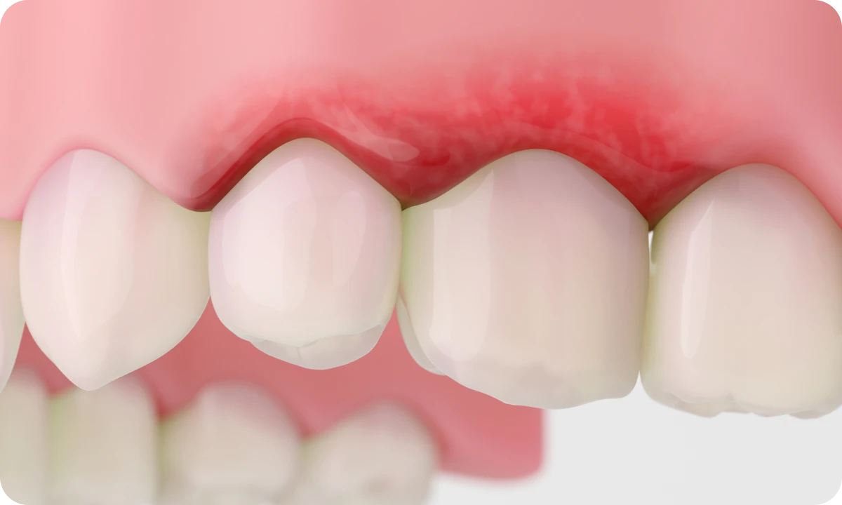 レントゲン検査