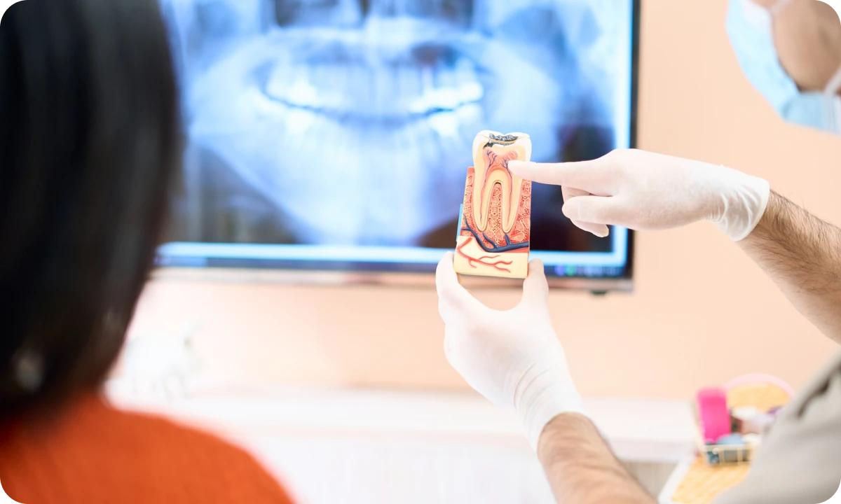 口腔内写真撮影