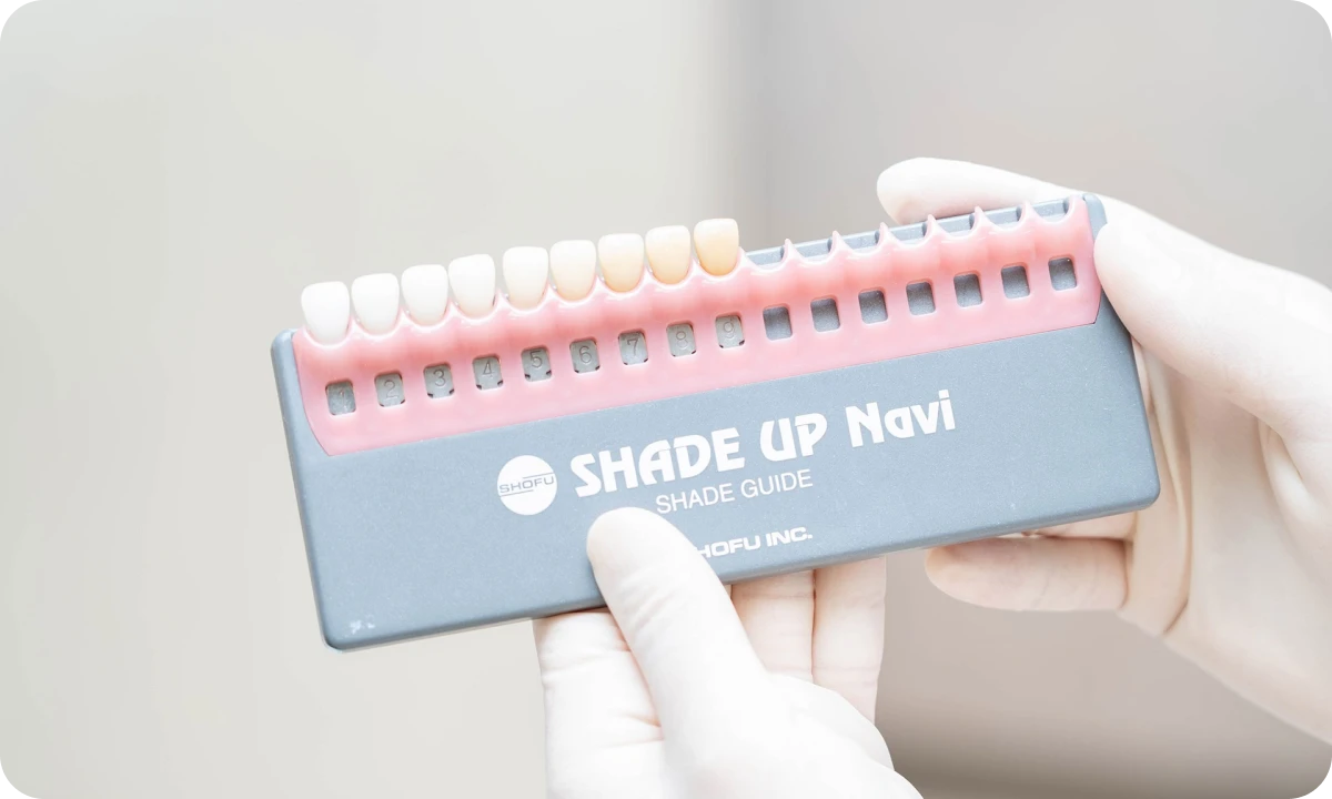 ホワイトニングについて